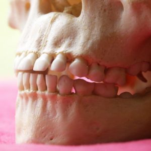 Dental Hygiene: Ancient Artefacts